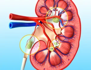 Benefits of UroFresh